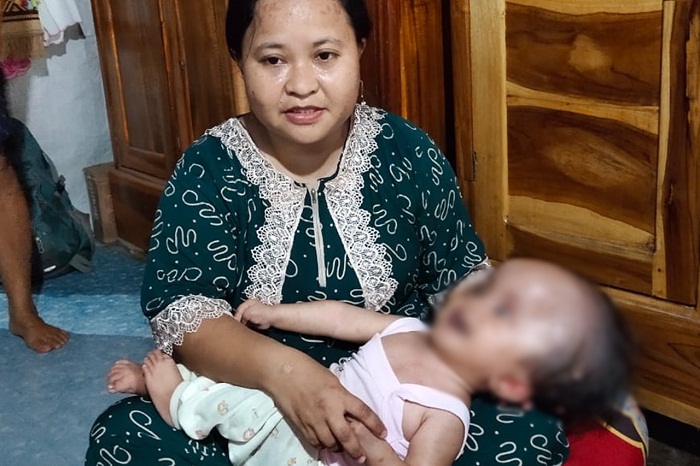 Respon Cepat Balai Anak Toddopuli Tangani Balita Penderita Hidrosefalus di Jeneponto